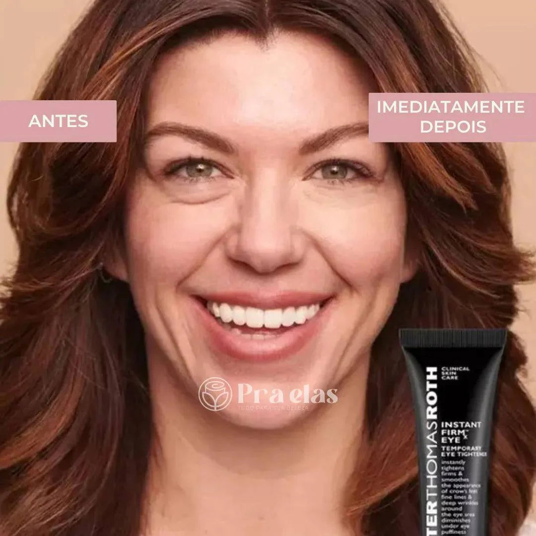 Creme Antirrugas Instantâneo - (8 Horas de Duração)